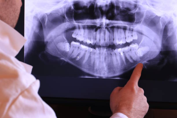 Best Emergency Dental Care for Broken or Chipped Teeth in Brazoria, TX